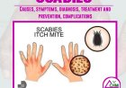 Scabies : Causes, symptoms, diagnosis, treatment, prevention and complications