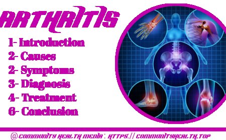 Arthritis : Symptoms and causes, diagnosis and test, management and treatment