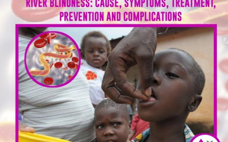 Onchocerciasis : causes, symptoms, diagnosis, treatment, prevention and complications