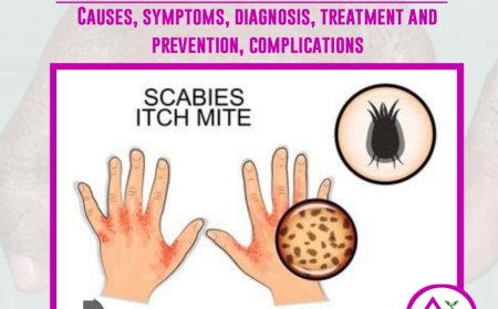 Scabies : Causes, symptoms, diagnosis, treatment, prevention and complications