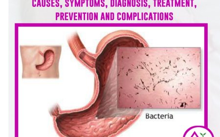 Diarrhea : causes, sign and symptoms, treatment, and prevention measure