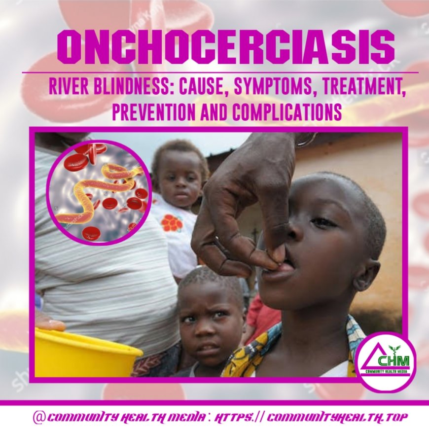 Onchocerciasis : causes, symptoms, diagnosis, treatment, prevention and complications