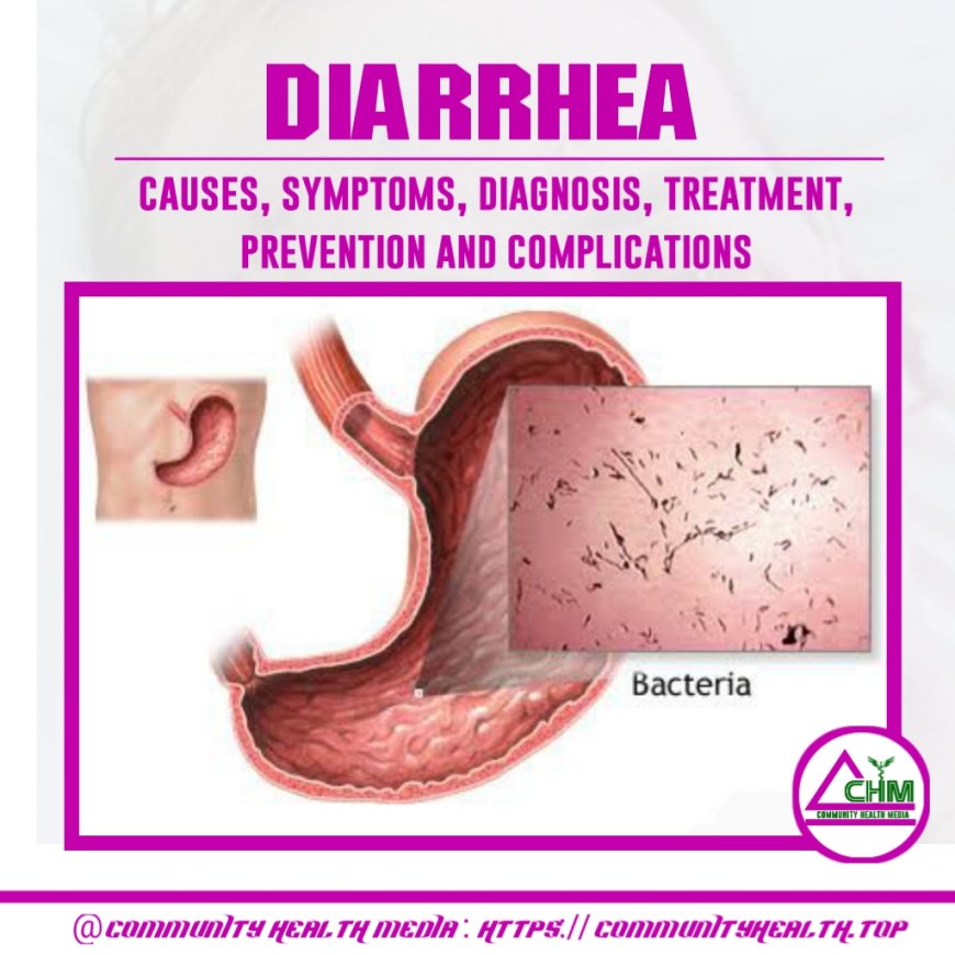 Diarrhea : causes, sign and symptoms, treatment, and prevention measure