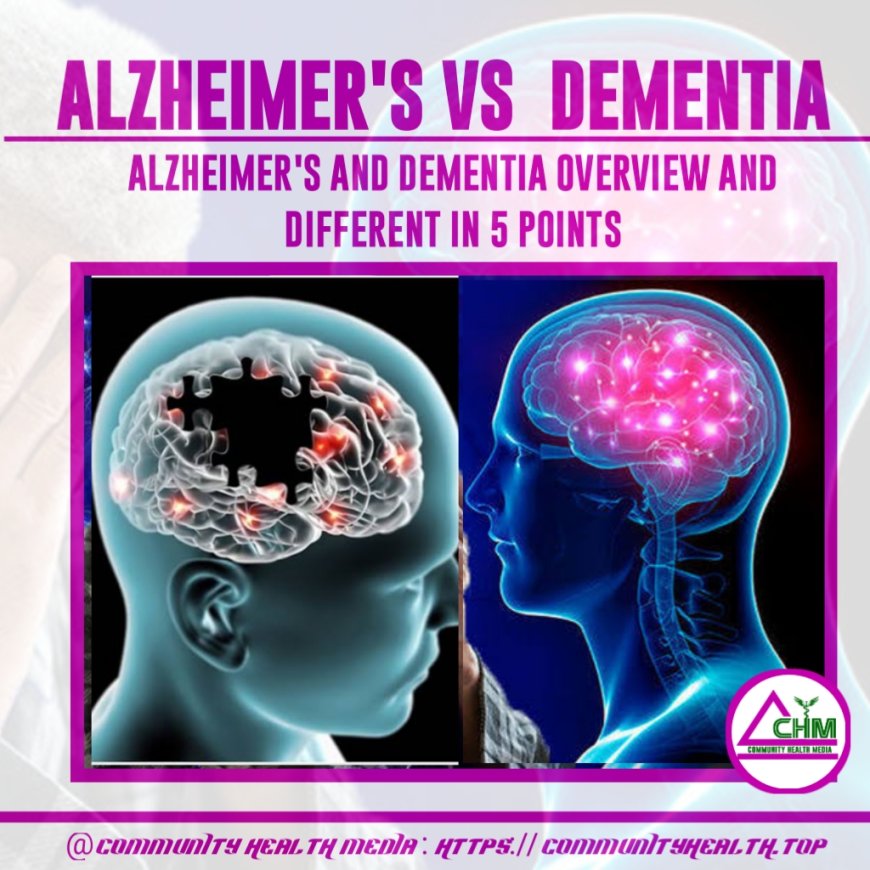 Deffrent between Alzheimer's and Dementia