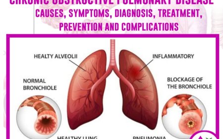 Chronic Obstructive Pulmonary Disease (COPD): Symptoms, Causes, Diagnosis, and Treatment - Naija health media