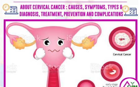 Mock Test on Cervical Cancer: 20 Questions with Instant Result - Naija Health Media