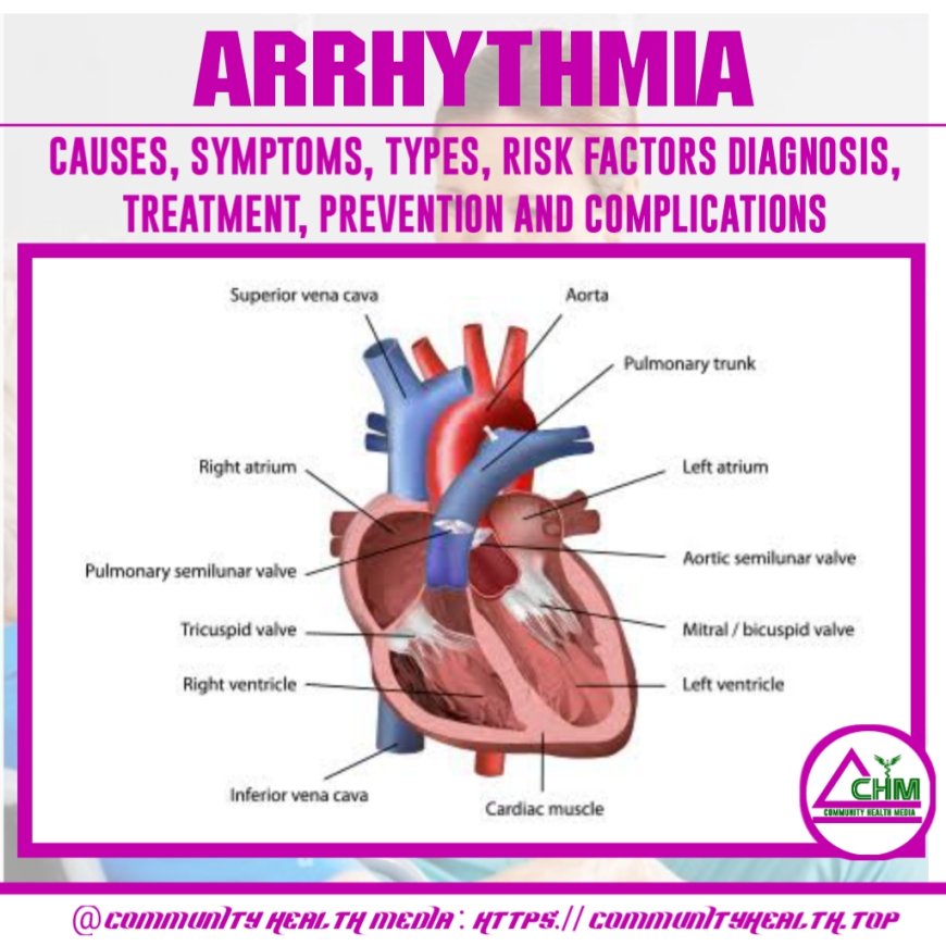 Arrhythmia : causes, symptoms, diagnosis, treatment, prevention and complications - Naija health media