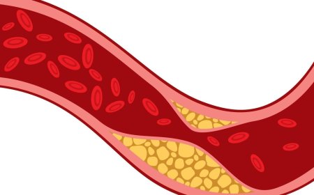 Cholesterol sinadari ne dake da amfani ajiki,jiki na amfani dashi wajen Samar da sinadarai masu amfani kamar 'vitamins da hormones',yakan zama matsala ne alokacin da yayi yawa acikin jini